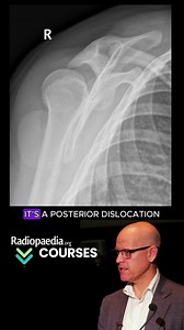 19K views · 126 reactions | What is the  sign? Craig Hacking...