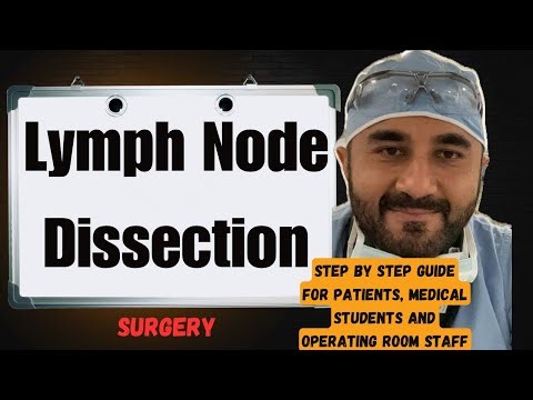 What to Expect for Robotic Lymph Node Dissection Surgery 😳(Step by step guide) Must See 👀 ❤️