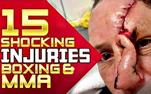 【双字榜单】MMA格斗史上15个最严重的受伤事件；慎入！血腥场面可能引起不适！（15 Most Shocking Injuries In Boxing_MMA）