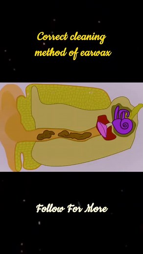 Safe Earwax Removal Procedure Explained