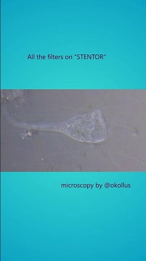 All filters on | Stentor feeding under the microscope! #microscopy #biology #nature #shorts