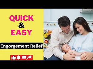 Hand Expressing Milk to Relieve Engorgement