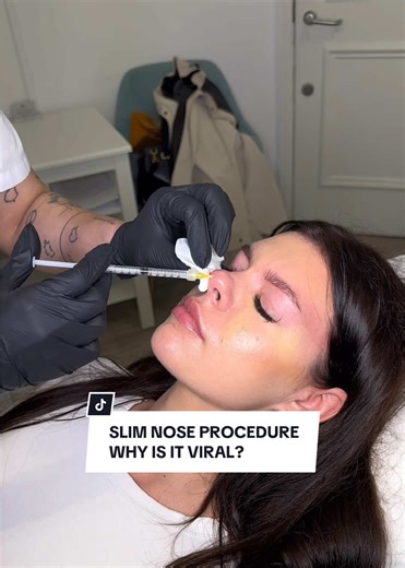 Slim Nose Procedure: Benefits and Booking Information