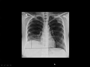 12 Film Reporting Chest - prof.Mamdouh Mahfouz (2019 edition)