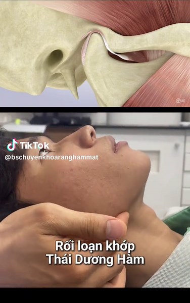 Rối loạn khớp thái dương hàm và nguyên nhân đau