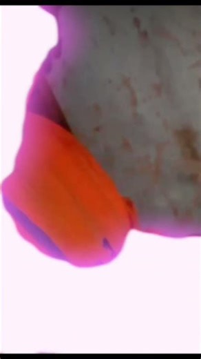 Anonymous Gang ft Dollen B– Wunna Vibes (Official Mixtape Preview) | Inspired by Gunna 🐍🌍”