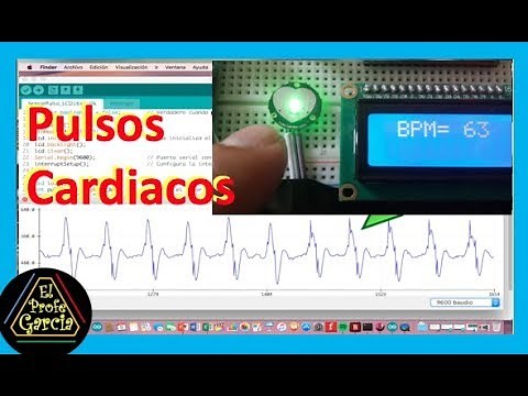 ✅ How to easily measure heart rate with Arduino (Heartbeat or Heart Pulse)