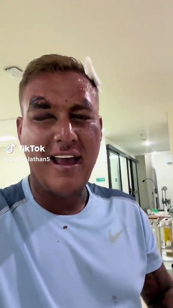 Life in a Bali Hospital: Lessons Learned