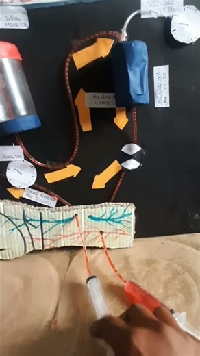 Dialysis Model / dialysis system model