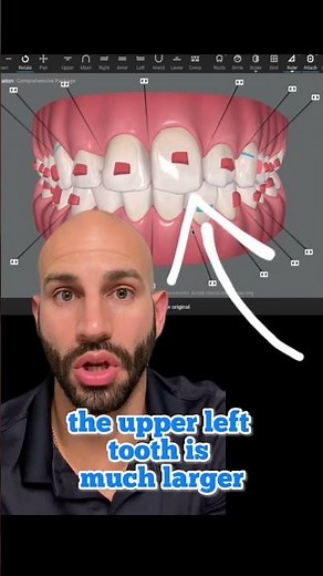 What to do if your two front teeth are different sizes.