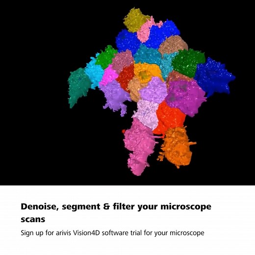 arivis Vision4D is your modular software for multi-channel 2D, 3D and 4D images of almost unlimited size, highly scalable and independent of local system resources. Many modern microscope systems such as high-speed confocal, light sheet, super-resolution, electron microscopy or X-ray instruments can produce huge amounts of imaging data. Handle your datasets without constraints and get your results in next to no time! For quantification of 3D image data the arivis Analysis Pipeline offers a robus