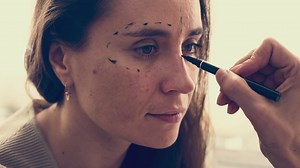 'Zoom dysmorphia:' People are making permanent changes to their faces