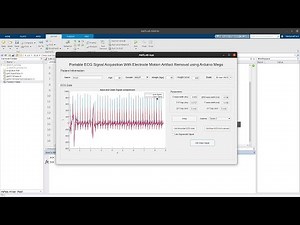 Portable ECG Signal Acquisition With Electrode Motion Artifact Removal using Arduino
