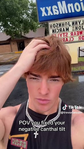 How to Fix a Negative Canthal Tilt: Natural & Surgical Options