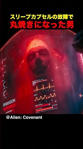 スリープカプセルの故障で丸焼きになった男