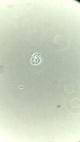 Fountain water under the microscope [joke footage included]