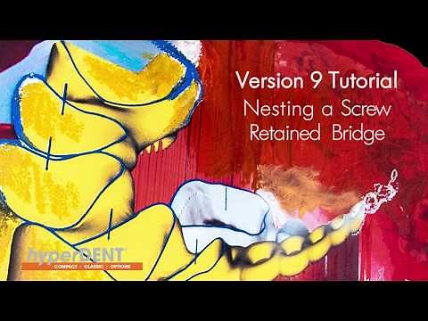 hyperDENT V9 Tutotial: Nesting a Screw-Retained Bridge