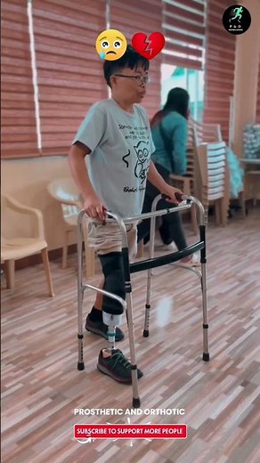 Hospital Practice to Outdoor Steps — His Strong Rehabilitation Journey #prostheticlimb