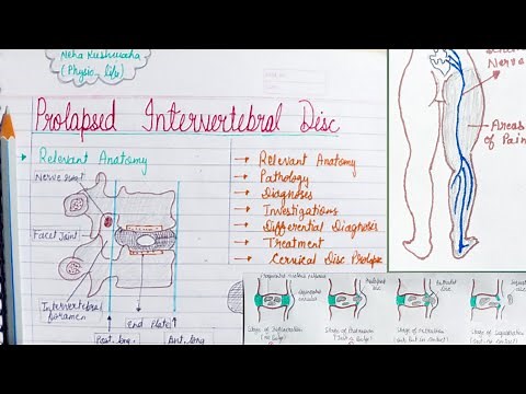 Prolapsed intervertebral disc(PIVD) - (part-1)