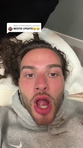 Microdermabrasion Facial: My Skin Feels SO Fresh! 😍