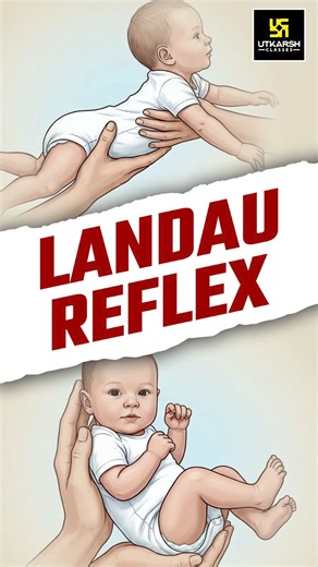Utkarsh Nursing Classes on Instagram: "Landau Reflex Follow for more information ✨ . . . #utkarshnursing #utkarshclasses"