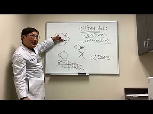 Scotoma in Tilted Disc Syndrome