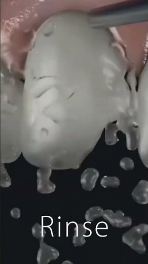 Simplify your anterior composite restorations