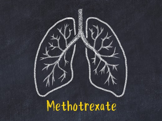 Méthotrexate : indication, effets secondaires, grossesse