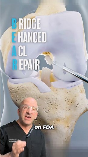 New Surgical Technique Could Save Your Torn ACL⁉️