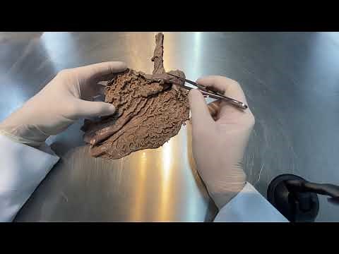 Stomach - Anatomy and general functions