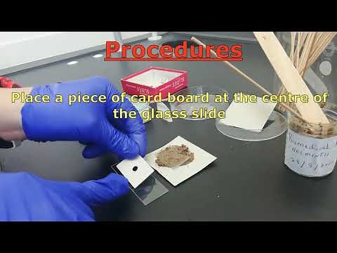 Kato–Katz technique