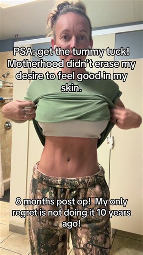 Motherhood didn’t erase my desire to feel good in my skin. 8 months post op TT, MR, Lipo and mons lift. My only regret is not doing it 10 years ago! #mom #fitness #selfcare #love