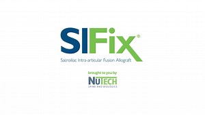 SI-FIX patient video available to have in office to educate patients or they can be refered to our website.  https://www.si-fix.com/SI-FIX   may be performed in a less invasive way than Competitive… | Jim Wall