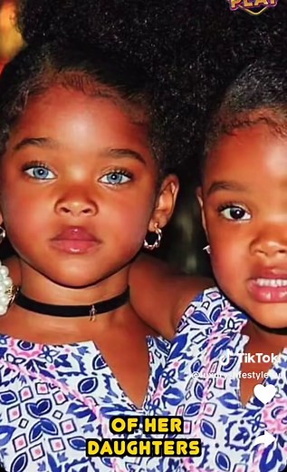 The Transformation of the Rarest Twins: Megan and Morgan Boyd