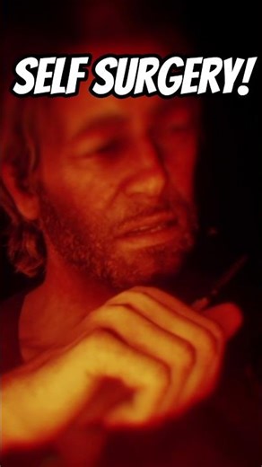 Arthur Performs CRAZY Self Surgery with Gun Powder and Fire #shorts #rdr2