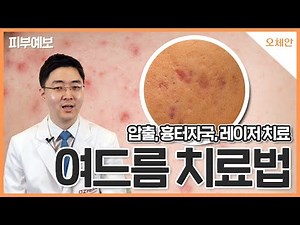 [오체안피부과] 여드름 치료법의 모든 것! 여드름 흉터 자국 여드름 없애는 법 I 피부 좋아지는 방법
