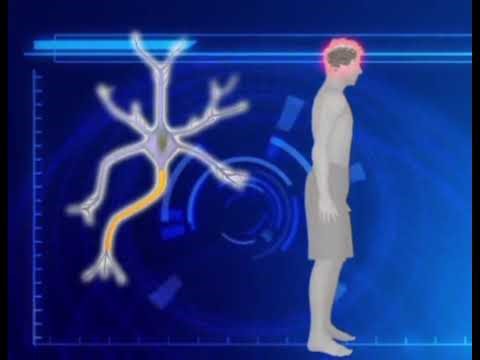 3D animation of muscle cramps/spasms