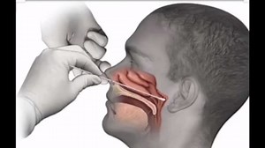 LabCorp at-home COVID-19 test approved by FDA could be game-changer