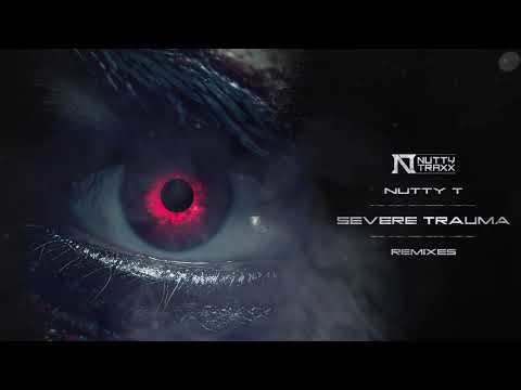 Nutty T - Severe Trauma (Hakka Remix)