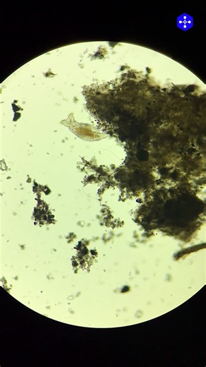 #shotoncilika #rotifer #microscopeview #medprime #lifeunderthelens | Medprime Technologies