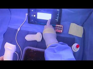 Ultrasound Scanning For A Paracentesis