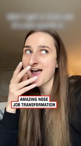 5M views · 27K reactions | It completely changed her face 朗 | LADbible | Facebook