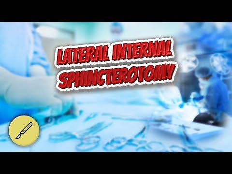 Lateral internal sphincterotomy - Everything Surgeries ✅😬⁉️
