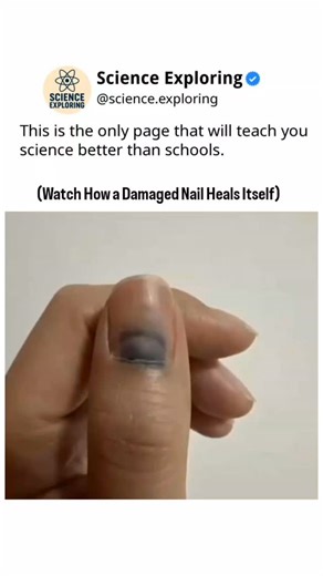 Science on Instagram: "Our body has an incredible ability to repair itself — even something as small as a nail. This timelapse captures the slow yet amazing process of nail healing, showing how new cells form, grow, and restore what was once damaged. The human body truly is a masterpiece of nature. . . . #HumanDecode #NailHealing #BodyRecovery #HumanBody #HealingProcess #Timelapse #Regeneration #BodyScience #HumanFacts #NatureOfHumans #MindBlowingFacts #ScienceOfHealing #AmazingBody #SelfHealing