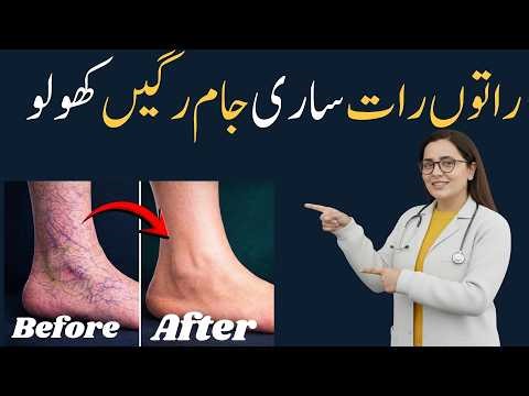 Poor Leg Circulation? 30-Second Test + 3 Instant Fix Drinks | Dr Aisha Khan
