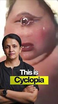 The Rarest Eye Condition In The World 😱