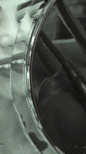 Bramty’s smile makeover before and after !