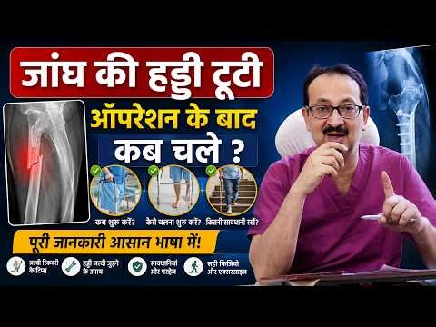 How to Walk After Femur Fracture Surgery | Step-by-Step Recovery Guide