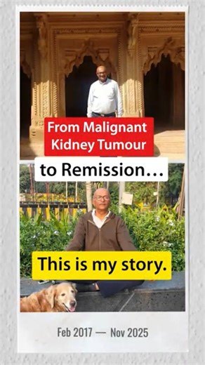 When 63-year-old Sandeep came to us, he wasn’t just recovering from a partial nephrectomy for a malignant kidney tumor…he was stepping into a second chance at life. His biggest fear wasn’t just the past… it was the possibility of cancer returning. ✔️ Along with a 🔍 history of cancer, he was struggling with excess weight, breathlessness, acidity, constipation, and inflammation…all of which silently create a favourable internal terrain for disease to thrive. When we look at cancer, our approach g