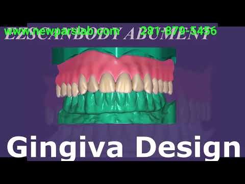 Digital Denture Workflow: Impression, Scan, and Lab Export using the existing denture